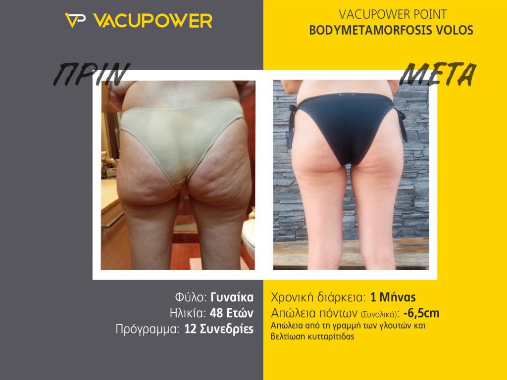 vacupower αποτελέσματα