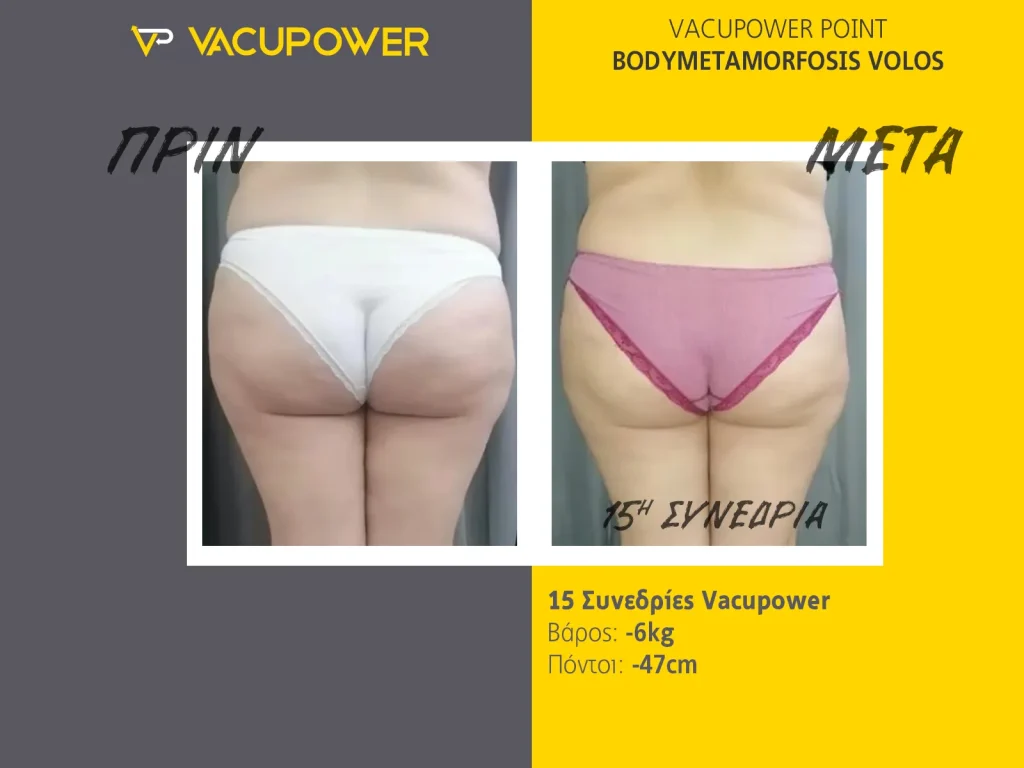 vacupower αποτελέσματα