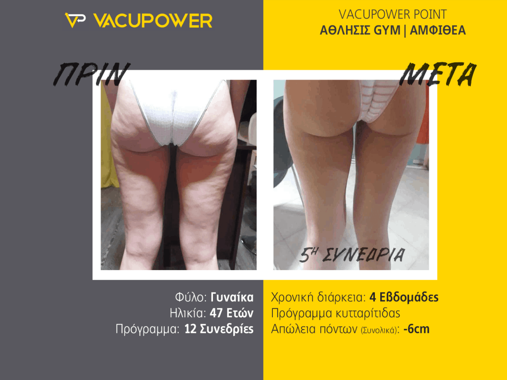 vacupower αποτελέσματα