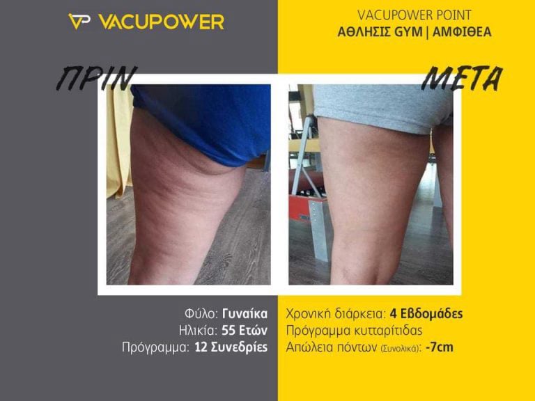 vacupower αποτελέσματα
