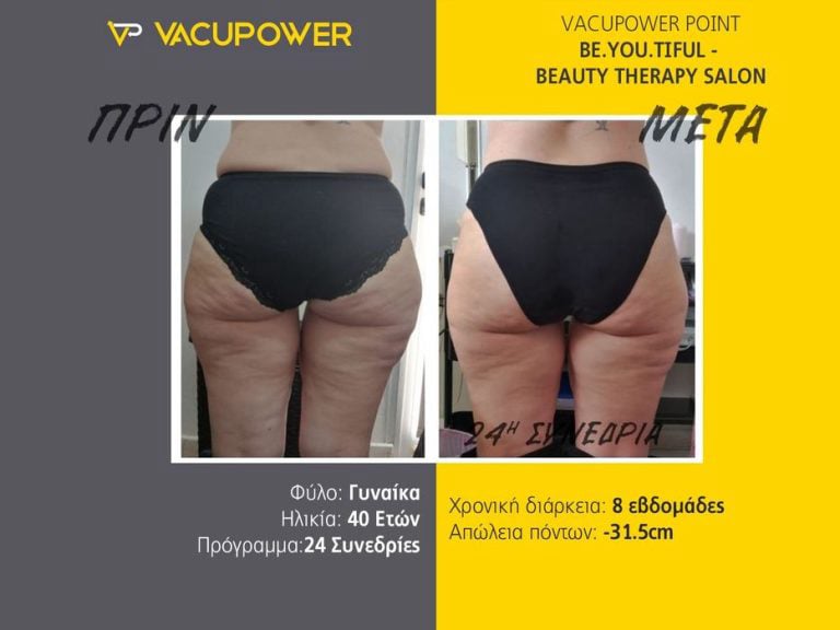 vacupower αποτελέσματα